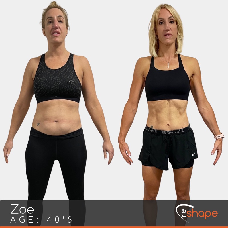 Zoe - Before and After Transformation